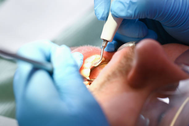 Best Urgent Dental Care for Toothaches in Hermann, MO